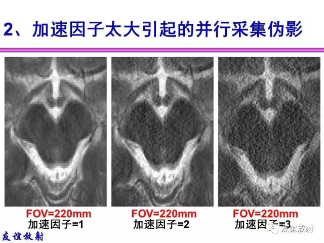 【PPT】MRI伪影与对策