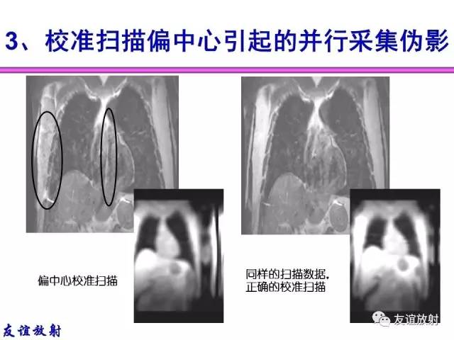 【PPT】MRI伪影与对策