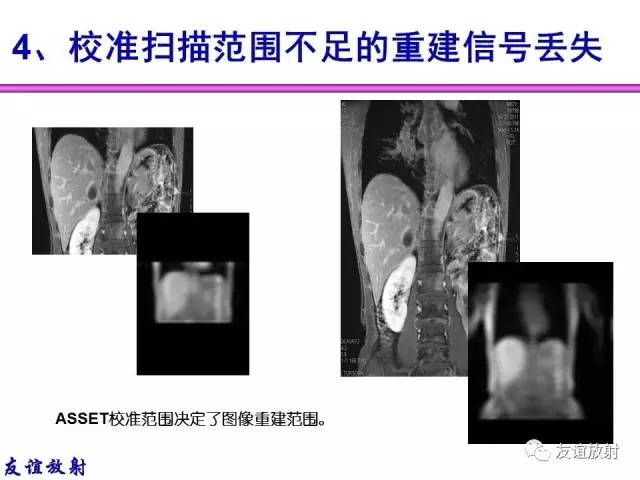 【PPT】MRI伪影与对策