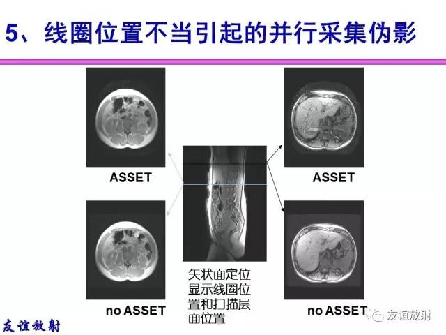 【PPT】MRI伪影与对策