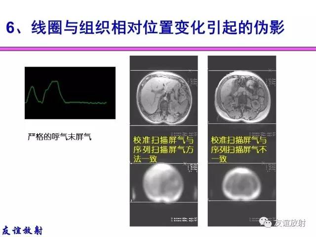 【PPT】MRI伪影与对策