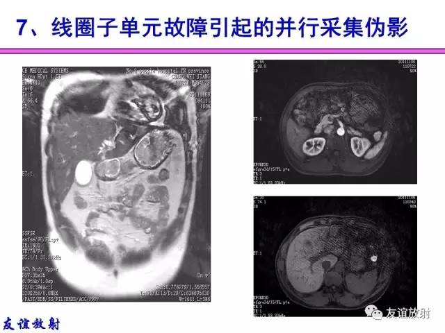 【PPT】MRI伪影与对策