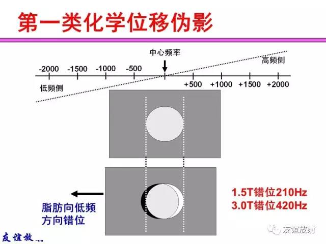 【PPT】MRI伪影与对策