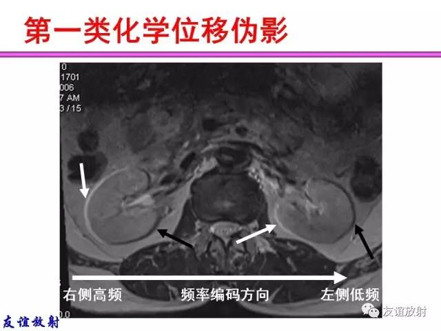 【PPT】MRI伪影与对策
