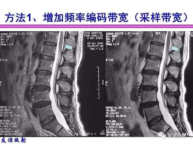 【PPT】MRI伪影与对策