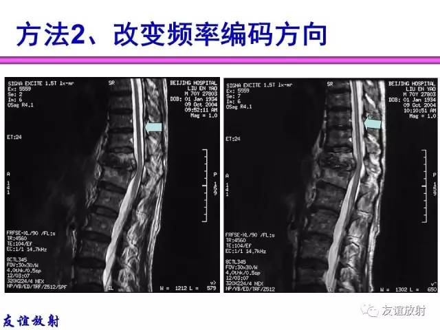 【PPT】MRI伪影与对策