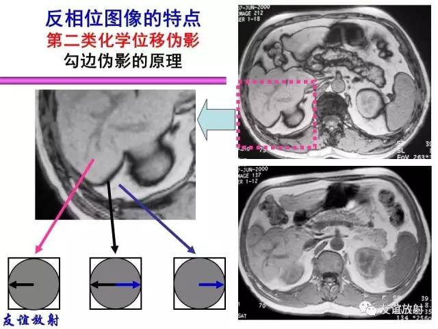 【PPT】MRI伪影与对策