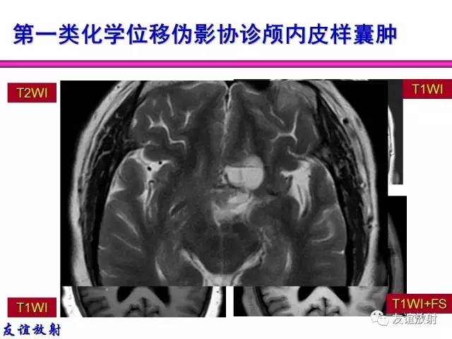 【PPT】MRI伪影与对策