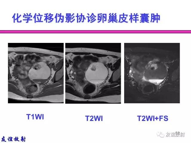 【PPT】MRI伪影与对策