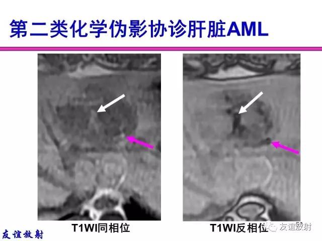 【PPT】MRI伪影与对策