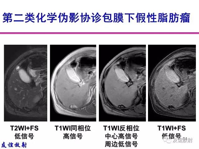 【PPT】MRI伪影与对策