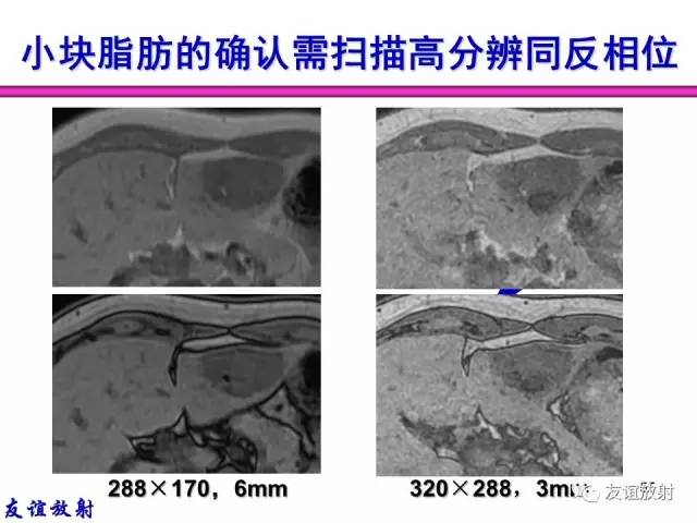 【PPT】MRI伪影与对策
