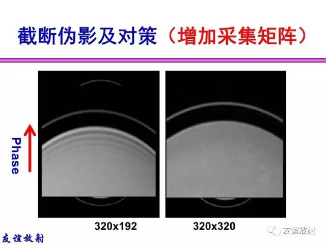 【PPT】MRI伪影与对策