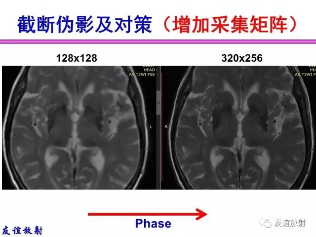 【PPT】MRI伪影与对策