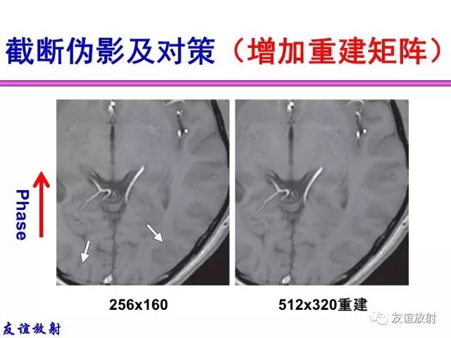 【PPT】MRI伪影与对策