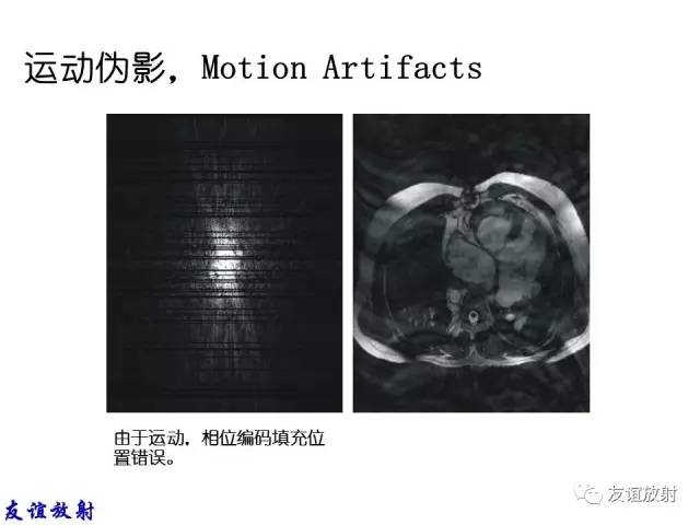 【PPT】MRI伪影与对策