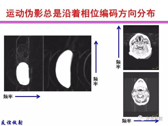 【PPT】MRI伪影与对策