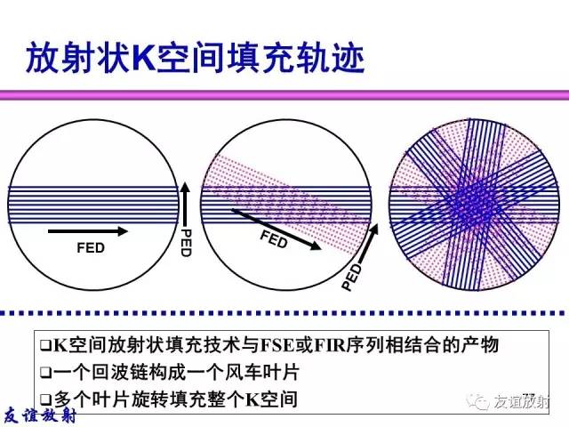 【PPT】MRI伪影与对策