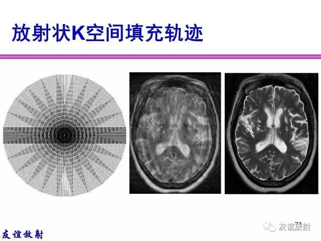 【PPT】MRI伪影与对策