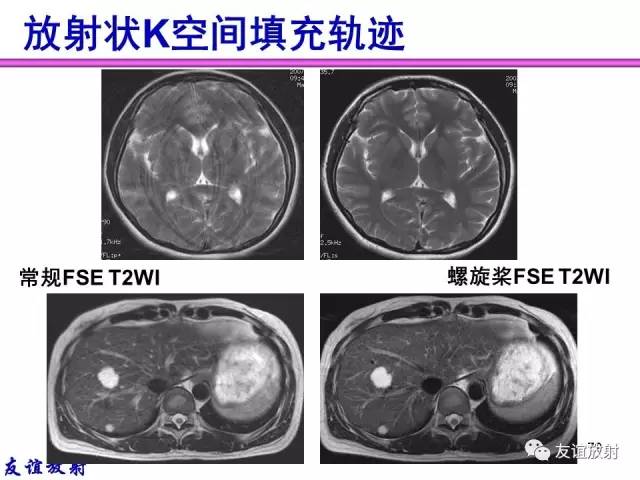 【PPT】MRI伪影与对策