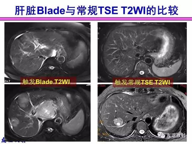 【PPT】MRI伪影与对策