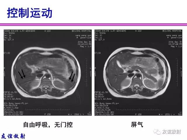 【PPT】MRI伪影与对策