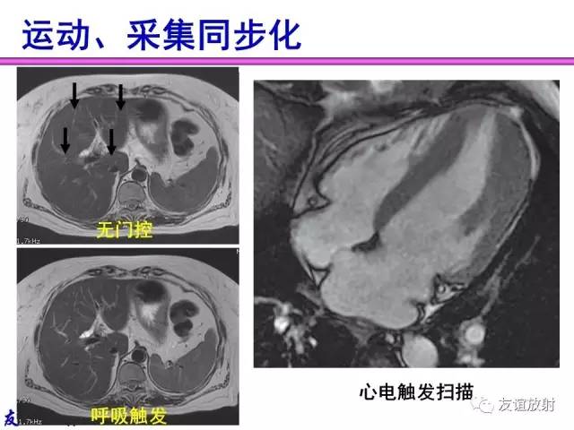 【PPT】MRI伪影与对策