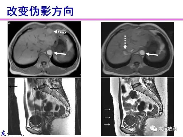 【PPT】MRI伪影与对策