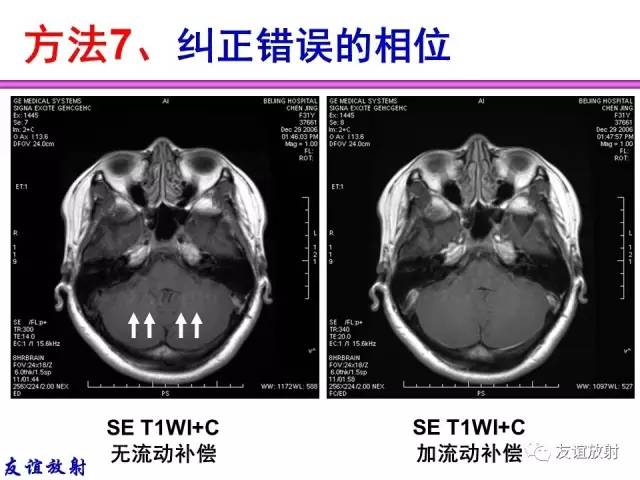 【PPT】MRI伪影与对策