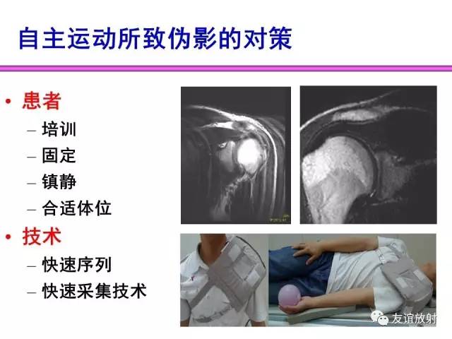 【PPT】MRI伪影与对策
