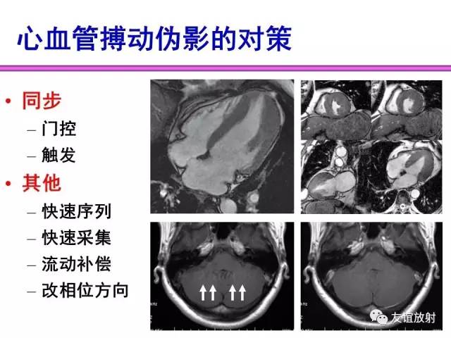 【PPT】MRI伪影与对策