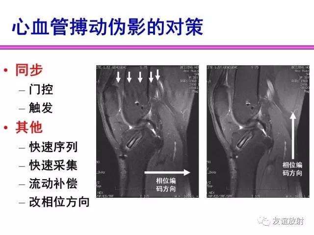 【PPT】MRI伪影与对策