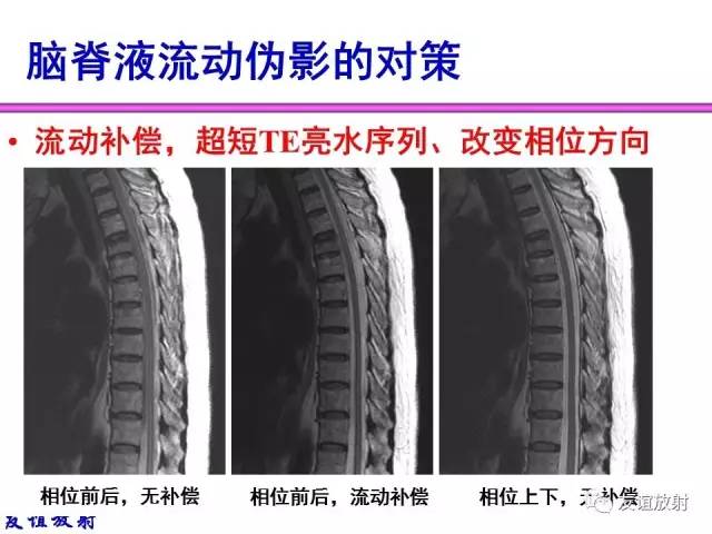 【PPT】MRI伪影与对策