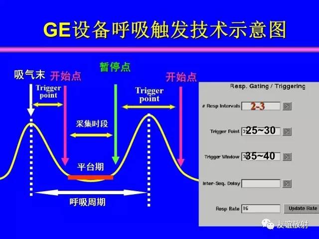 【PPT】MRI伪影与对策