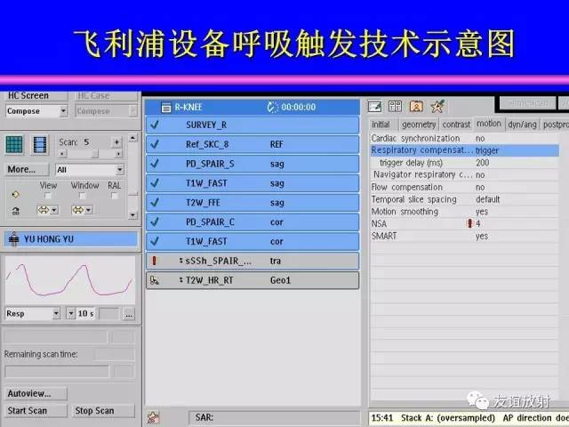 【PPT】MRI伪影与对策