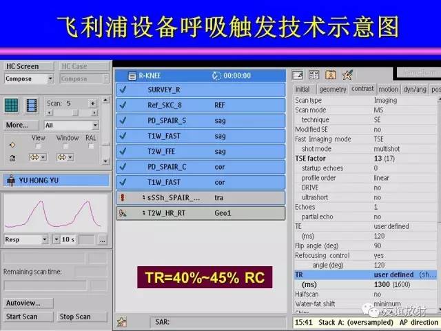 【PPT】MRI伪影与对策