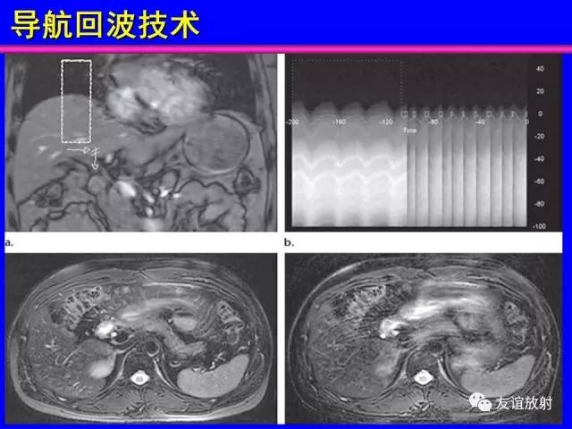 【PPT】MRI伪影与对策
