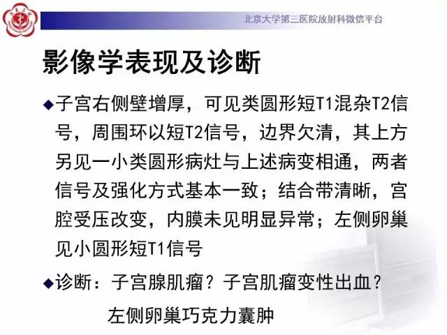 【病例】子宫腺肌症1例MR影像诊断分析