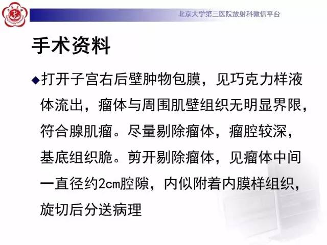 【病例】子宫腺肌症1例MR影像诊断分析