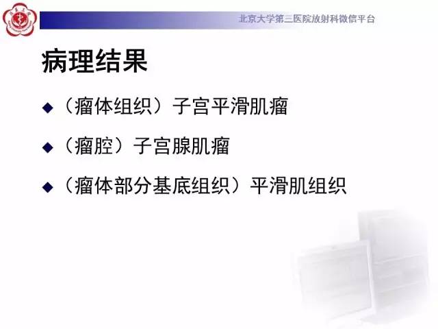 【病例】子宫腺肌症1例MR影像诊断分析