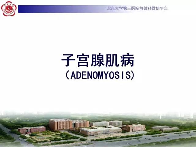 【病例】子宫腺肌症1例MR影像诊断分析