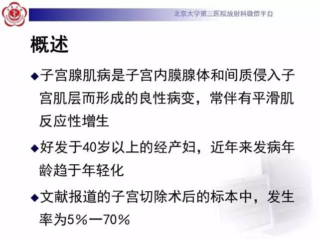 【病例】子宫腺肌症1例MR影像诊断分析