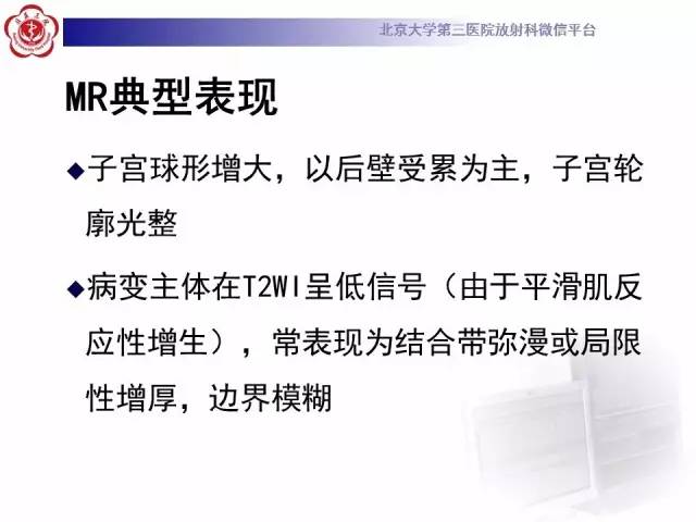 【病例】子宫腺肌症1例MR影像诊断分析