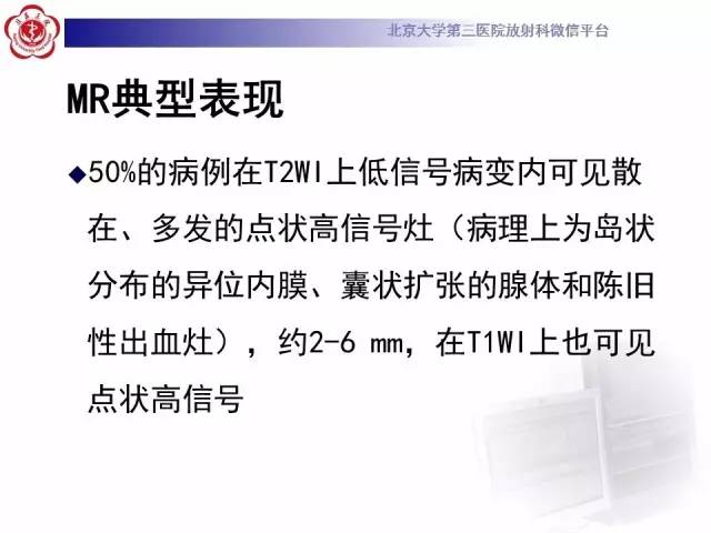 【病例】子宫腺肌症1例MR影像诊断分析