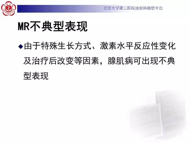 【病例】子宫腺肌症1例MR影像诊断分析