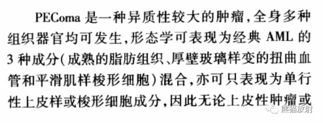 胰腺非上皮及上皮肿瘤鉴别之影像病理相关表现