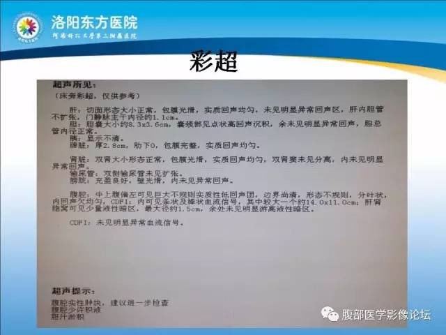 【病例】胃淋巴瘤1例CT 【病例】胃淋巴瘤1例CT