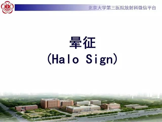 【PPT】晕征与反晕征