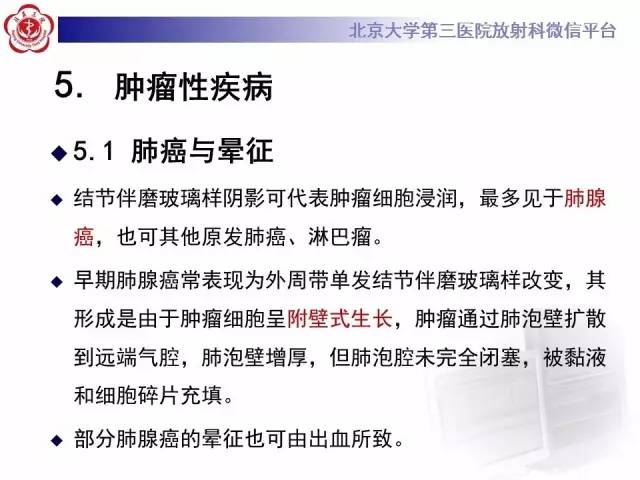 【PPT】晕征与反晕征