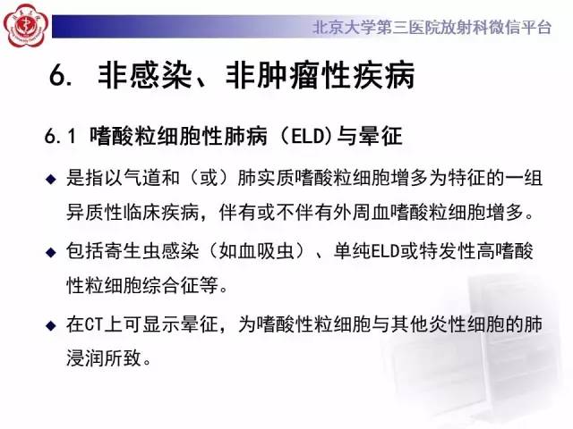 【PPT】晕征与反晕征